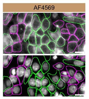 <b>Genetic Strategies Validation. </b>HCT 116 WT and Casein Kinase 1 alpha KD cells were labelled with a green or a far-red fluorescent dye, respectively. Cells were stained with Human/Mouse/Rat Casein Kinase 1 alpha Antigen Affinity-purified Polyclonal Antibody (Catalog # AF4569) followed by incubation with a donkey anti-sheep Alexa-fluor 555 coupled secondary antibody (upper panel). DAPI-only counterstained cells shown on a lower panel. Acquisition of the blue (nucleus-DAPI), green (identification of WT cells), red (antibody staining) and far-red (identification of KD cells) channels was performed. Representative images of the blue and red (grayscale) channels are shown. WT and KD cells are outlined with green and magenta dashed line, respectively. Primary antibody concentration used: 2 µg/mL. Image, protocol and testing courtesy of YCharOS Inc. (ycharos.com).