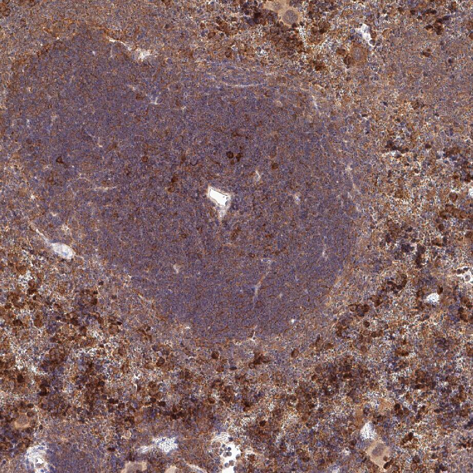 In the presence of Recombinant Mouse M-CSF (20 ng/mL, 416-ML), Recombinant Mouse TRANCE/TNFSF11/RANK L (462-TR) induces osteoclast-like cell formation in RAW 264.7 cells in a dose-dependent manner (orange line), as measured by TRAP (tartrate-resistant acid phosphatase) solution assay. Under these conditions, osteoclast-like cell formation elicited by Recombinant Mouse TRANCE/TNFSF11/ RANK L (30 ng/mL) is neutralized (green line) by increasing concentrations of Goat Anti-Mouse TRANCE/TNFSF11/RANK L Antigen Affinity-purified Polyclonal Antibody (Catalog # AF462). The ND50 is typically VCTS021). Tissue was stained using the HRP-conjugated Anti-Goat IgG Secondary Antibody (Catalog # HAF109) and counterstained with hematoxylin (blue). Specific staining was localized to the membrane. View our protocol for Chromogenic IHC Staining of Paraffin-embedded Tissue Sections.