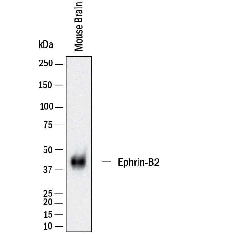 Western Blot Ephrin-B2 Antibody [Unconjugated]