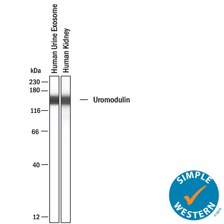 Simple Western shows lysates of Exosome Standards (Human Urine) (NBP2-49840) and human kidney tissue, loaded at 0.5 mg/ml. A specific band was detected for Uromodulin at approximately 149 kDa (as indicated) using 50 µg/mL of Sheep Anti-Human Uromodulin Antigen Affinity-purified Polyclonal Antibody (Catalog # AF5144). This experiment was conducted under reducing conditions and using the 12-230kDa separation system.