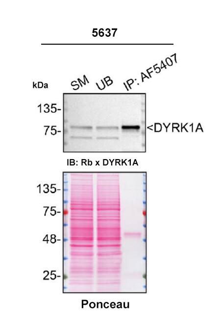 5637 cell line lysates were prepared and immunoprecipitation was performed using 2.0 μg of Sheep Anti-Human/Rat DYRK1A Antigen Affinity-purified Polyclonal Antibody (Catalog # AF5407) pre-coupled to Dynabeads Protein G. Immunoprecipitated DYRK1A was detected in Western Blot with a rabbit anti-DYRK1A antibody used at 1/1000. The Ponceau stained transfer of the blot is shown. SM=4% starting material; UB=4% unbound fraction; IP=immunoprecipitate; HC=antibody heavy chain. Image, protocol and testing courtesy of YCharOS Inc. (ycharos.com).