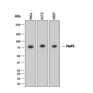 Western Blot FoxP2 Antibody [Unconjugated]