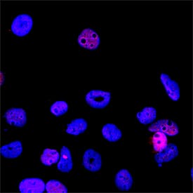 Immunocytochemistry ING1 Antibody [Unconjugated]