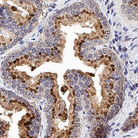 ST6 Gal Sialyltransferase 1/ST6GAL1 was detected in immersion fixed paraffin-embedded sections of human prostate using Goat Anti-Human ST6 Gal Sialyltransferase 1/ST6GAL1 Antigen Affinity-purified Polyclonal Antibody (Catalog # AF5924) at 1 &micro;g/mL for 1 hour at room temperature followed by incubation with the Anti-Goat IgG VisUCyte&trade; HRP Polymer Antibody (VC004). Before incubation with the primary antibody, tissue was subjected to heat-induced epitope retrieval using Antigen Retrieval Reagent-Basic (CTS013). Tissue was stained using DAB (brown) and counterstained with hematoxylin (blue). Specific staining was localized to cytoplasm in glandular epithelial cells. Staining was performed using our protocol for IHC Staining with VisUCyte HRP Polymer Detection Reagents.