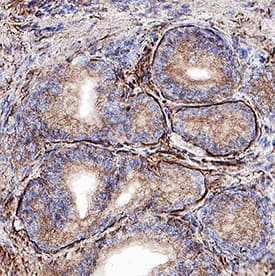 Palladin was detected in immersion fixed paraffin-embedded sections of Human Prostate using Sheep Anti-Human Palladin Antigen Affinity-purified Polyclonal Antibody (Catalog # AF5950) at 10 µg/mL for 1 hour at room temperature followed by incubation with the Anti-Sheep IgG VisUCyte™ HRP Polymer Antibody (Catalog # VC006). Before incubation with the primary antibody, tissue was subjected to heat-induced epitope retrieval using VisUCyte Antigen Retrieval Reagent-Basic (Catalog # VCTS021). Tissue was stained using DAB (brown) and counterstained with hematoxylin (blue). Specific staining was localized to smooth muscle cells. View our protocol for IHC Staining with VisUCyte HRP Polymer Detection Reagents.