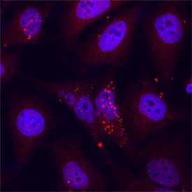 Nucleoporin NUP85 was detected in immersion fixed HeLa human cervical epithelial carcinoma cell line using Sheep Anti-Human Nucleoporin NUP85 Antigen Affinity-purified Polyclonal Antibody (Catalog # AF5976) at 5 &micro;g/mL for 3 hours at room temperature. Cells were stained using the NorthernLights&trade; 557-conjugated Anti-Sheep IgG Secondary Antibody (red; NL010) and counterstained with DAPI (blue). Specific staining was localized to cytoplasm. Staining was performed using our protocol for Fluorescent ICC Staining of Non-adherent Cells.