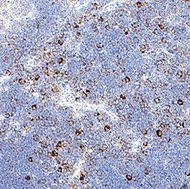 Limitin/IFN‑ zeta  was detected in immersion fixed paraffin-embedded sections of mouse thymus using Goat Anti-Mouse Limitin/IFN‑ zeta  Antigen Affinity-purified Polyclonal Antibody (Catalog # AF597) at 1 µg/ml for 1 hour at room temperature followed by incubation with the Anti-Goat IgG VisUCyte™ HRP Polymer Antibody (Catalog # VC004) or the HRP-conjugated Anti-Goat IgG Secondary Antibody (Catalog # HAF109). Before incubation with the primary antibody, tissue was subjected to heat-induced epitope retrieval using VisUCyte Antigen Retrieval Reagent-Basic (Catalog # VCTS021). Tissue was stained using DAB (brown) and counterstained with hematoxylin (blue). Specific staining was localized to the membrane of lymphocytes. View our protocol for Chromogenic IHC Staining of Paraffin-embedded Tissue Sections.