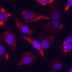 Importin  alpha 2/KPNA2 was detected in immersion fixed HeLa human cervical epithelial carcinoma cell line using Sheep Anti-Human Importin  alpha 2/KPNA2 Antigen Affinity-purified Polyclonal Antibody (Catalog # AF6207) at 5 &micro;g/mL for 3 hours at room temperature. Cells were stained using the NorthernLights&trade; 557-conjugated Anti-Sheep IgG Secondary Antibody (red; NL010) and counterstained with DAPI (blue). Specific staining was localized to cytoplasm. Staining was performed using our protocol for Fluorescent ICC Staining of Non-adherent Cells.