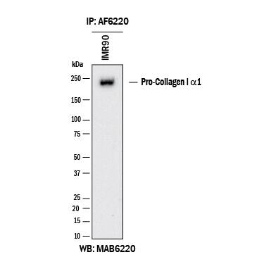Human N-Pro Collagen I was immunoprecipitated from 500 μg of IMR‑90 human lung fibroblast cell line lysates with 5 μg of Sheep Anti-Human N-Pro Collagen I Antigen Affinity-purified Polyclonal Antibody (Catalog # AF6220). The N-Pro Collagen I-antibody complexes were absorbed using Protein A or Protein G. Immunoprecipitated human N-Pro Collagen I was detected by Western blot using 1 μg/mL of Mouse Anti-Human N-Pro Collagen I Monoclonal Antibody (MAB6220) under reducing conditions and using Western Blot Buffer Group 1.