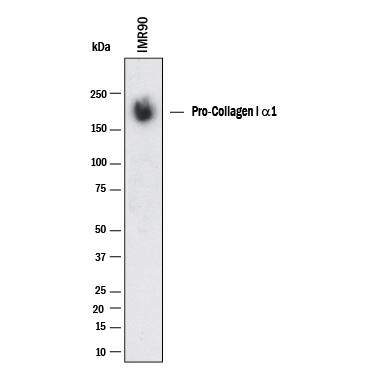 Western blot shows lysates of IMR‑90 human lung fibroblast cell line. PVDF membrane was probed with 1 µg/mL of Sheep Anti-Human Pro Collagen I  alpha 1 Antigen Affinity-purified Polyclonal Antibody (Catalog # AF6220) followed by HRP-conjugated Anti-Sheep IgG Secondary Antibody (HAF016). A specific band was detected for Collagen I at approximately 170 kDa (as indicated). This experiment was conducted under reducing conditions and using Western Blot Buffer Group 1.