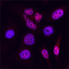 Immunocytochemistry ONECUT2/OC-2 Antibody [Unconjugated]