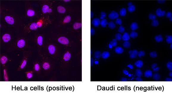 DNMT3A was detected in immersion fixed HeLa human cervical epithelial carcinoma cell line (positive staining) and Daudi human Burkitt's lymphoma cell line (negative staining) using Goat Anti-Human DNMT3A Antigen Affinity-purified Polyclonal Antibody (Catalog # AF6315) at 15 &micro;g/mL for 3 hours at room temperature. Cells were stained using the NorthernLights&trade; 557-conjugated Anti-Goat IgG Secondary Antibody (red; NL001)  and counterstained with DAPI (blue). Specific staining was localized to cell nuclei. Staining was performed using our protocol for Fluorescent ICC Staining of Non-adherent Cells.