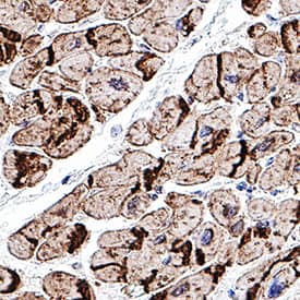 Immunohistochemistry N-Cadherin Antibody [Unconjugated]