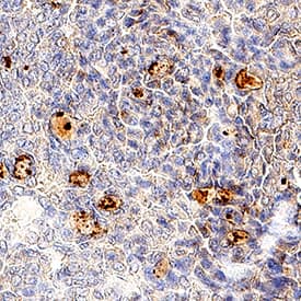 Immunohistochemistry RAMP1 Antibody [Unconjugated]