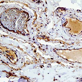 Immunohistochemistry CCL26/Eotaxin-3 Antibody [Unconjugated]