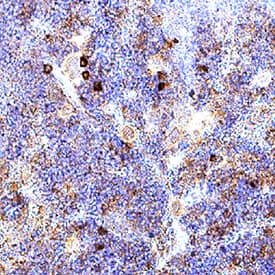 <b>Biological Strategies Validation. </b>TIGIT was detected in immersion fixed paraffin-embedded sections of mouse spleen using Sheep Anti-Mouse TIGIT Antigen Affinity-purified Polyclonal Antibody (Catalog # AF7267) at 3 &micro;g/mL for 1 hour at room temperature followed by incubation with the Anti-Sheep IgG VisUCyte&trade; HRP Polymer Antibody (VC006). Before incubation with the primary antibody, tissue was subjected to heat-induced epitope retrieval using Antigen Retrieval Reagent-Basic (CTS013). Tissue was stained using DAB (brown) and counterstained with hematoxylin (blue). Specific staining was localized to lymphocytes. Staining was performed using our protocol for IHC Staining with VisUCyte HRP Polymer Detection Reagents.
