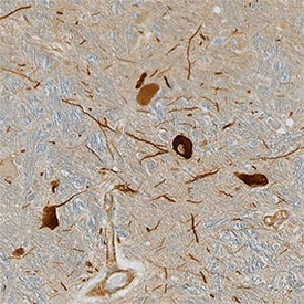 Tyrosine Hydroxylase was detected in immersion fixed paraffin-embedded sections of human brain (medulla) using Sheep Anti-Human/Mouse/Rat Tyrosine Hydroxylase Antigen Affinity-purified Polyclonal Antibody (Catalog # AF7566) at 15 &micro;g/mL for 1 hour at room temperature followed by incubation with the Anti-Sheep IgG VisUCyte&trade; HRP Polymer Antibody (VC006). Before incubation with the primary antibody, tissue was subjected to heat-induced epitope retrieval using Antigen Retrieval Reagent-Basic (CTS013). Tissue was stained using DAB (brown) and counterstained with hematoxylin (blue). Specific staining was localized to cytoplasm in neurons. Staining was performed using our protocol for IHC Staining with VisUCyte HRP Polymer Detection Reagents.
