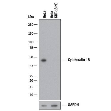 Knockout Validated Cytokeratin 18 Antibody [Unconjugated]