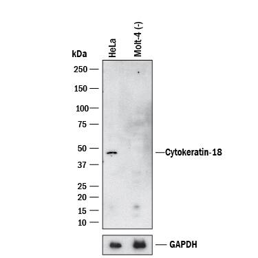 Western Blot Cytokeratin 18 Antibody [Unconjugated]