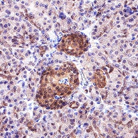 PTEN was detected in immersion fixed paraffin-embedded sections of human pancreas using Rabbit Anti-Human/Mouse/Rat PTEN Antigen Affinity-purified Polyclonal Antibody (Catalog # AF847) at 3 &micro;g/mL for 1 hour at room temperature followed by incubation with the Anti-Rabbit IgG VisUCyte&trade; HRP Polymer Antibody (VC003). Before incubation with the primary antibody, tissue was subjected to heat-induced epitope retrieval using Antigen Retrieval Reagent-Basic (CTS013). Tissue was stained using DAB (brown) and counterstained with hematoxylin (blue). Specific staining was localized to cytoplasm in islet cells. Staining was performed using our protocol for IHC Staining with VisUCyte HRP Polymer Detection Reagents.
