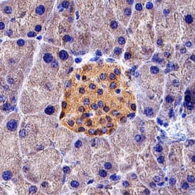 PTEN was detected in immersion fixed paraffin-embedded sections of mouse pancreas using Rabbit Anti-Human/Mouse/Rat PTEN Antigen Affinity-purified Polyclonal Antibody (Catalog # AF847) at 3 &micro;g/mL for 1 hour at room temperature followed by incubation with the Anti-Rabbit IgG VisUCyte&trade; HRP Polymer Antibody (VC003). Before incubation with the primary antibody, tissue was subjected to heat-induced epitope retrieval using Antigen Retrieval Reagent-Basic (CTS013). Tissue was stained using DAB (brown) and counterstained with hematoxylin (blue). Specific staining was localized to cytoplasm in islet cells. Staining was performed using our protocol for IHC Staining with VisUCyte HRP Polymer Detection Reagents.