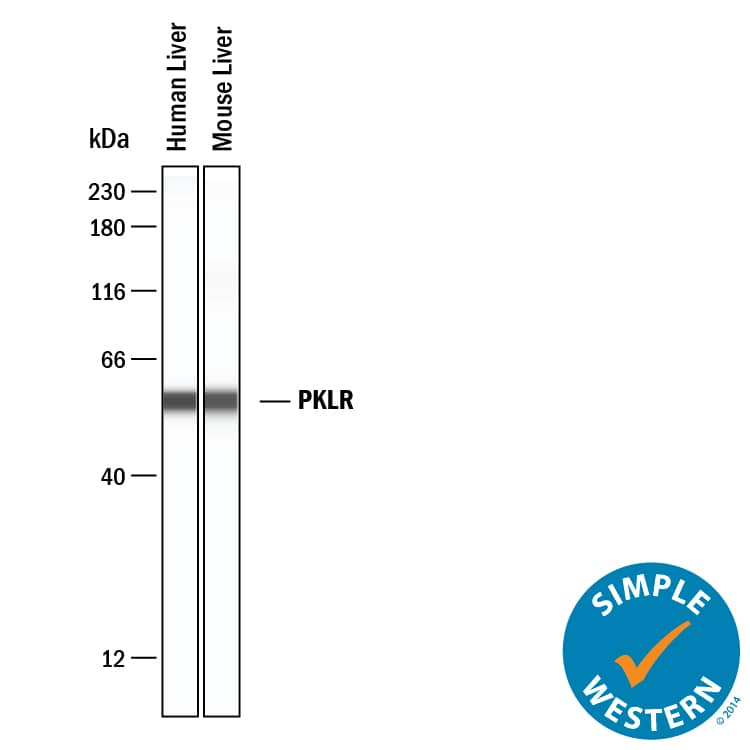 Simple Western PKLR Antibody [Unconjugated]