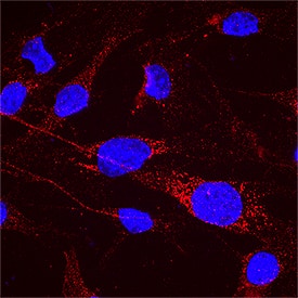 Immunocytochemistry IMPDH1 Antibody [Unconjugated]