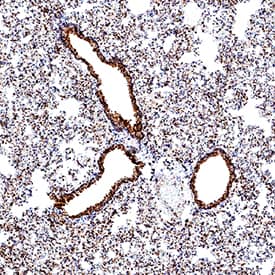 ACE‑2 was detected in immersion fixed paraffin-embedded sections of hamster lung using Goat Anti-Human/Mouse/Rat/Hamster ACE‑2 Antigen Affinity-purified Polyclonal Antibody (Catalog # AF933) at 3 &micro;g/mL for 1 hour at room temperature followed by incubation with the Anti-Goat IgG VisUCyte&trade; HRP Polymer Antibody (VC004). Before incubation with the primary antibody, tissue was subjected to heat-induced epitope retrieval using Antigen Retrieval Reagent-Basic (CTS013). Tissue was stained using DAB (brown) and counterstained with hematoxylin (blue). Specific staining was localized to respiratory bronchioles. Staining was performed using our protocol for IHC Staining with VisUCyte HRP Polymer Detection Reagents.