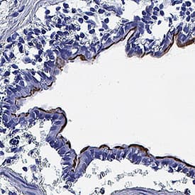 ACE‑2 was detected in immersion fixed frozen sections of rat lung using Goat Anti-Human/Mouse/Rat/Hamster ACE‑2 Antigen Affinity-purified Polyclonal Antibody (Catalog # AF933) at 10 &micro;g/mL for 1 hour at room temperature followed by incubation with the Anti-Goat IgG VisUCyte&trade; HRP Polymer Antibody (VC004). Before incubation with the primary antibody, tissue was subjected to heat-induced epitope retrieval using Antigen Retrieval Reagent-Basic (CTS013). Tissue was stained using DAB (brown) and counterstained with hematoxylin (blue). Specific staining was localized to cell surface in eputhelial cells in bronchioles. Staining was performed using our protocol for IHC Staining with VisUCyte HRP Polymer Detection Reagents.