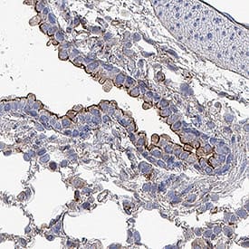 ACE‑2 was detected in immersion fixed paraffin-embedded sections of rat lung using Goat Anti-Human/Mouse/Rat/Hamster ACE‑2 Antigen Affinity-purified Polyclonal Antibody (Catalog # AF933) at 10 &micro;g/mL for 1 hour at room temperature followed by incubation with the Anti-Goat IgG VisUCyte&trade; HRP Polymer Antibody (VC004). Before incubation with the primary antibody, tissue was subjected to heat-induced epitope retrieval using Antigen Retrieval Reagent-Basic (CTS013). Tissue was stained using DAB (brown) and counterstained with hematoxylin (blue). Staining was performed using our protocol for IHC Staining with VisUCyte HRP Polymer Detection Reagents.