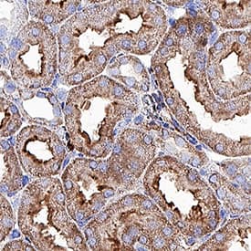 ACE‑2 was detected in immersion fixed paraffin-embedded sections of rat kidney using Goat Anti-Human/Mouse/Rat/Hamster ACE‑2 Antigen Affinity-purified Polyclonal Antibody (Catalog # AF933) at 10 &micro;g/mL for 1 hour at room temperature followed by incubation with the Anti-Goat IgG VisUCyte&trade; HRP Polymer Antibody (VC004). Before incubation with the primary antibody, tissue was subjected to heat-induced epitope retrieval using Antigen Retrieval Reagent-Basic (CTS013). Tissue was stained using DAB (brown) and counterstained with hematoxylin (blue).  Specific staining was localized to cell surface in convoluted tubules. Staining was performed using our protocol for IHC Staining with VisUCyte HRP Polymer Detection Reagents.