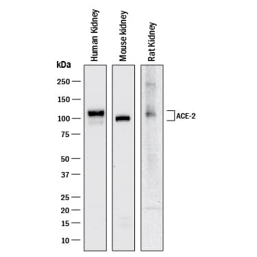 Western blot shows lysates of human kidney tissue, mouse kidney tissue, and rat kidney tissue. PVDF membrane was probed with 1 µg/mL of Goat Anti-Human/Mouse/Rat/Hamster ACE-2 Antigen Affinity-purified Polyclonal Antibody (Catalog # AF933) followed by HRP-conjugated Anti-Goat IgG Secondary Antibody (Catalog # HAF017). A specific band was detected for ACE-2 at approximately 100 and 110 kDa (as indicated). This experiment was conducted under reducing conditions and using Western Blot Buffer Group 1.