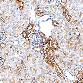 Rescue of ADAM9 expression restores EMCV replication in ADAM9 KO cells. WT and ADAM9 KO HeLa cells were transduced with retroviral vectors with wild-type (WT) murine ADAM9 (mADAM9), catalytically inactive mutant ADAM9 (E>A), cytoplasmic-tail-deleted ( delta CT) ADAM9 constructs, or GFP control vectors. (A) WT, KO, and rescue cell lysates were analyzed by Western blot using two different ADAM9 antibodies. Top panel, rabbit anti-human ADAM9 that detects an epitope in the intracellular domain of human ADAM9 and cross-reacts with mouse ADAM9 (black asterisk). Middle panel, goat anti-mouse ADAM9 that detects the extracellular domain of murine ADAM9 but not human ADAM9 (blue asterisk). Bottom panel, anti-actin which detects both human and murine  beta -actin. Top panel, WT but not KO cells expressed human ADAM9. Middle panel, rescue but not KO cells expressed murine ADAM9. Bottom panel, actin loading control. (B) WT clones, ADAM9 KO clones, and rescued ADAM9-expressing clones were infected with EMCV or CVB3 at various MOIs and incubated at 37°C for 24 h. Viability of EMCV-infected and CVB3-infected clones was measured by CellGlo ATP luminescence. (C) EMCV replication was quantified in infected culture supernatants by plaque assay. Neither the functional sequence of the ADAM9 metalloproteinase domain nor the cytoplasmic tail is required for EMCV infection. ***, P VC004). Before incubation with the primary antibody, tissue was subjected to heat-induced epitope retrieval using VisUCyte Antigen Retrieval Reagent-Basic (Catalog # VCTS021). Tissue was stained using DAB (brown) and counterstained with hematoxylin (blue). Specific staining was localized to the membrane. View our protocol for Chromogenic IHC Staining of Paraffin-embedded Tissue Sections.