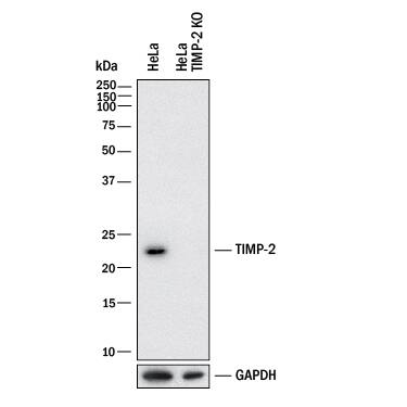 Knockout Validated TIMP-2 Antibody [Unconjugated]