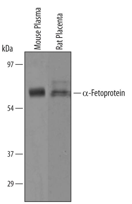 Western blot shows lysates of mouse plasma and rat placenta tissue. PVDF membrane was probed with 1 µg/mL of Mouse a-Fetoprotein/AFP Antigen Affinity-purified Polyclonal Antibody (Catalog # AF5369) followed by HRP-conjugated Anti-Goat IgG Secondary Antibody (Catalog # HAF019). A specific band was detected for a-Fetoprotein/AFP at approximately 70 kDa (as indicated). This experiment was conducted under reducing conditions and using Immunoblot Buffer Group 8.