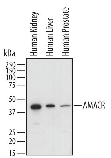 Western Blot alpha-Methylacyl-CoA Racemase/AMACR Antibody [Unconjugated]