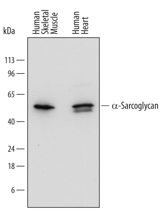 Western blot shows lysates of human skeletal muscle tissue and human heart tissue. PVDF membrane was probed with 1 µg/mL of Mouse Anti-Human a-Sarcoglycan Monoclonal Antibody (Catalog # MAB7445) followed by HRP-conjugated Anti-Mouse IgG Secondary Antibody (Catalog # HAF018). A specific band was detected for a-Sarcoglycan at approximately 50 kDa (as indicated). This experiment was conducted under reducing conditions and using Immunoblot Buffer Group 1.