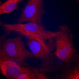 a-Actinin 1 was detected in immersion fixed A172 human glioblastoma cell line using Goat Anti-Human/Mouse/Rat a-Actinin 1 Antigen Affinity-purified Polyclonal Antibody (Catalog # AF8279) at 10 µg/mL for 3 hours at room temperature. Cells were stained using the NorthernLights™ 557-conjugated Anti-Goat IgG Secondary Antibody (red; Catalog # NL001) and counterstained with DAPI (blue). Specific staining was localized to cytoplasm. View our protocol for Fluorescent ICC Staining of Cells on Coverslips.
