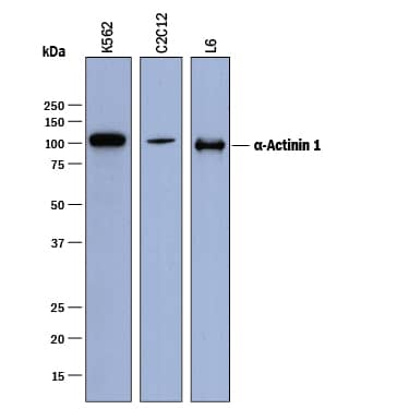 Western blot shows lysates of K562 human chronic myelogenous leukemia cell line, C2C12 mouse myoblast cell line, and L6 rat myoblast cell line. PVDF membrane was probed with 0.5 µg/mL of Goat Anti-Human/Mouse/Rat a-Actinin 1 Antigen Affinity-purified Polyclonal Antibody (Catalog # AF8279) followed by HRP-conjugated Anti-Goat IgG Secondary Antibody (Catalog # HAF017). A specific band was detected for a-Actinin 1 at approximately 100-105 kDa (as indicated). This experiment was conducted under reducing conditions and using Immunoblot Buffer Group 1.