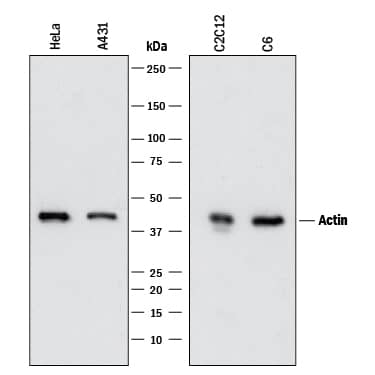 Western blot shows lysates of HeLa human cervical epithelial carcinoma cell line, A431 human epithelial carcinoma cell line, C2C12 mouse myoblast cell line, and C6 rat glioma cell line. PVDF membrane was probed with 2 µg/mL of Mouse Anti-Human/Mouse/Rat a-Cardiac Actin Monoclonal Antibody (Catalog # MAB93081) followed by HRP-conjugated Anti-Mouse IgG Secondary Antibody (HAF018). A specific band was detected for a-Cardiac Actin at approximately 40 kDa (as indicated). This experiment was conducted under reducing conditions and using Immunoblot Buffer Group 1.