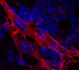 Immunocytochemistry Actin Alpha 1 Cardiac Muscle Antibody (959606) [Unconjugated]