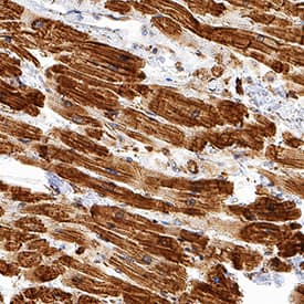 Immunohistochemistry Actin Alpha 1 Cardiac Muscle Antibody (959606) [Unconjugated]