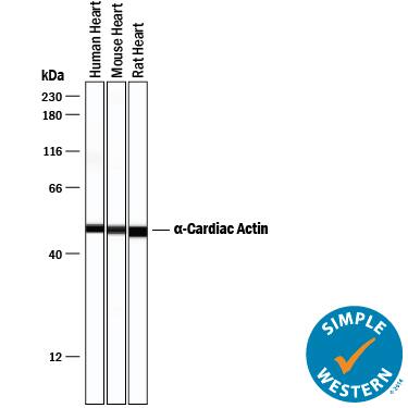 Simple Western Actin Alpha 1 Cardiac Muscle Antibody (959606) [Unconjugated]