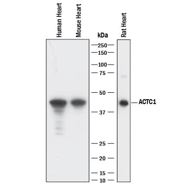 Western Blot Actin Alpha 1 Cardiac Muscle Antibody (959606) [Unconjugated]