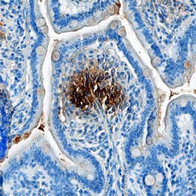 a-Defensin 1 was detected in formalin fixed paraffin-embedded sections of human small intestine using Sheep Anti-Human a-Defensin 1 Antigen Affinity-purified Polyclonal Antibody (Catalog # AF8198) at 1 µg/mL overnight at 4 °C. Tissue was stained using the Anti-Sheep HRP-DAB Cell & Tissue Staining Kit (brown; Catalog # CTS019) and counterstained with hematoxylin (blue). Specific staining was localized to lamina propria in intestinal villi. View our protocol for Chromogenic IHC Staining of Paraffin-embedded Tissue Sections.