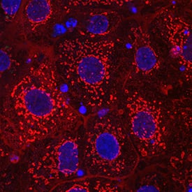 a-Fetoprotein/AFP was detected in immersion fixed BG01V human embryonic stem cells using Chicken Anti-Human/Rat a-Fetoprotein/AFP Antigen Affinity-purified Polyclonal Antibody (Catalog # AF1369) at 10 µg/mL for 3 hours at room temperature. Cells were stained using the NorthernLights™ 557-conjugated Anti-Chicken IgY Secondary Antibody (red; Catalog # NL016) and counterstained with DAPI(blue). Specific staining was localized to cytoplasm. View our protocol for Fluorescent ICC Staining of Cells on Coverslips.