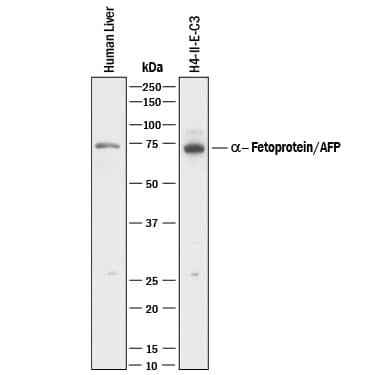 Western blot shows lysates of human liver tissue and H4‑II‑E‑C3 rat hepatoma cell line. PVDF membrane was probed with 0.2 µg/mL of Chicken Anti-Human/Rat  alpha ‑Fetoprotein/ AFP Antigen Affinity-purified Polyclonal Antibody (Catalog # AF1369) followed by HRP-conjugated Anti-Chicken IgY Secondary Antibody. A specific band was detected for  alpha ‑Fetoprotein/AFP at approximately 70 kDa (as indicated). This experiment was conducted under reducing conditions and using Immunoblot Buffer Group 1.