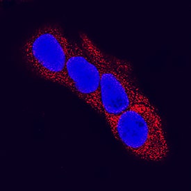 a-Fetoprotein/AFP was detected in immersion fixed HepG2 human hepatocellular carcinoma cell line using Mouse Anti-Human/Mouse a-Fetoprotein/AFP Monoclonal Antibody (Catalog # MAB1368) at 25 µg/mL for 3 hours at room temperature. Cells were stained using the NorthernLights™ 557-conjugated Anti-Mouse IgG Secondary Antibody (red; Catalog # NL007) and counterstained with DAPI (blue). Specific staining was localized to cytoplasm. View our protocol for Fluorescent ICC Staining of Cells on Coverslips.