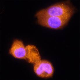 Immunocytochemistry alpha-L-Iduronidase/IDUA Antibody [Unconjugated]