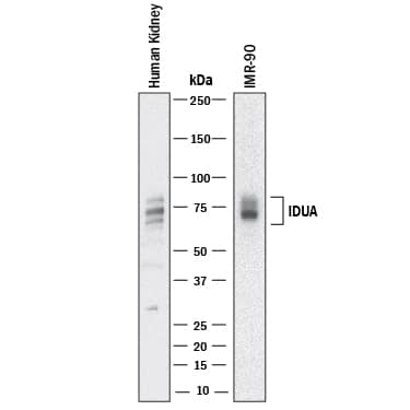 Western Blot alpha-L-Iduronidase/IDUA Antibody (452619) [Unconjugated]